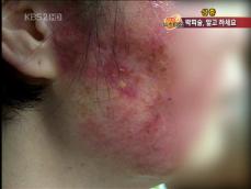 KBS 뉴스 이미지